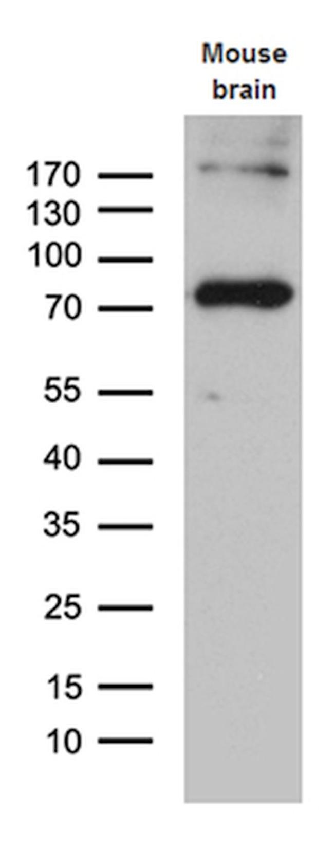 ACSL5 Antibody in Western Blot (WB)