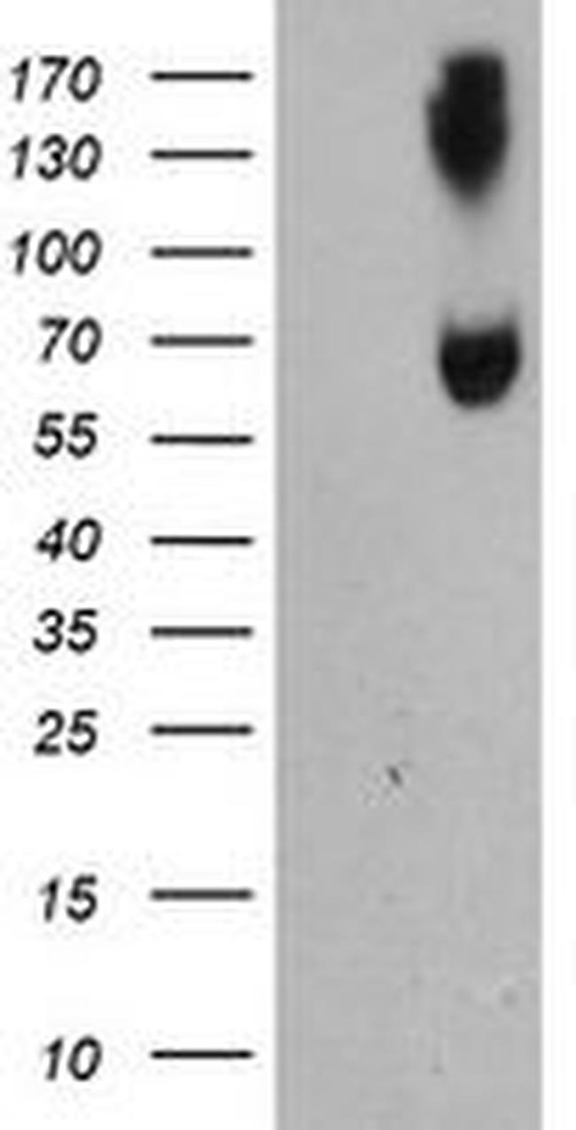 ACSM5 Antibody in Western Blot (WB)