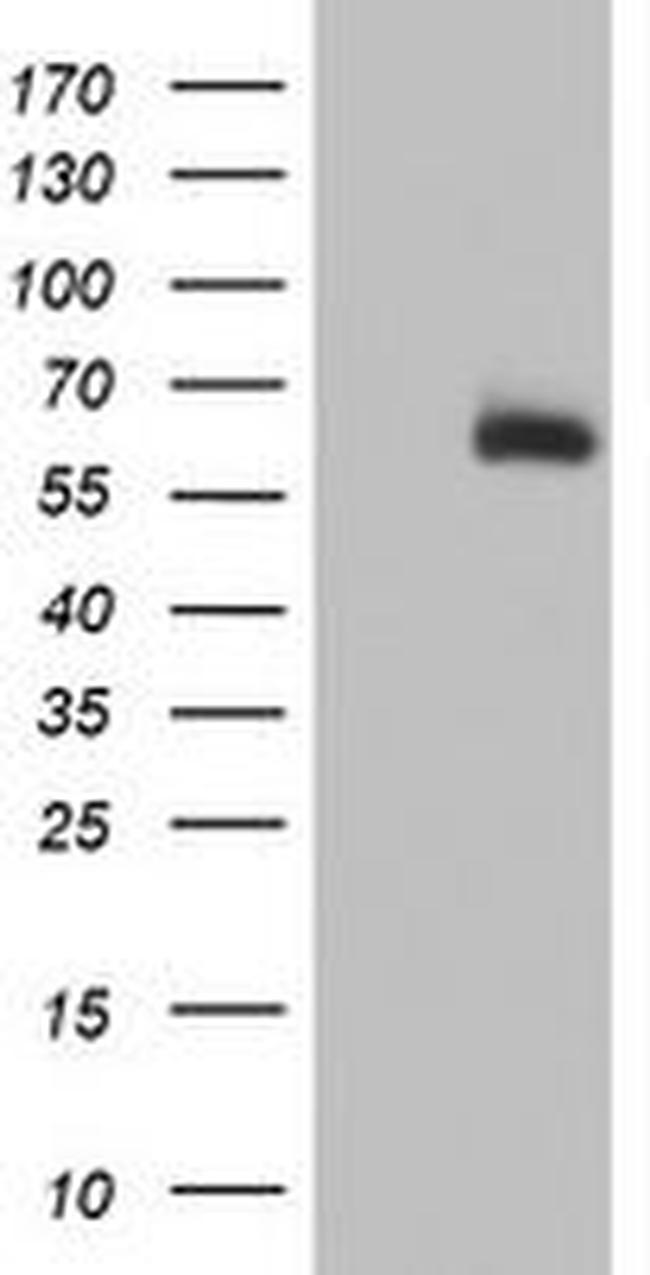 ACSM5 Antibody in Western Blot (WB)