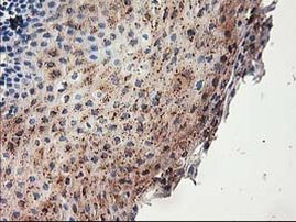 ACSS2 Antibody in Immunohistochemistry (Paraffin) (IHC (P))