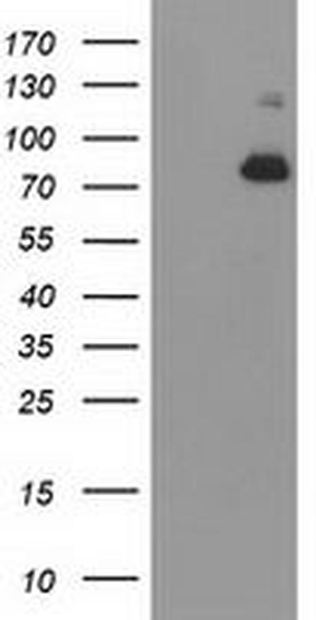 ACSS2 Antibody in Western Blot (WB)