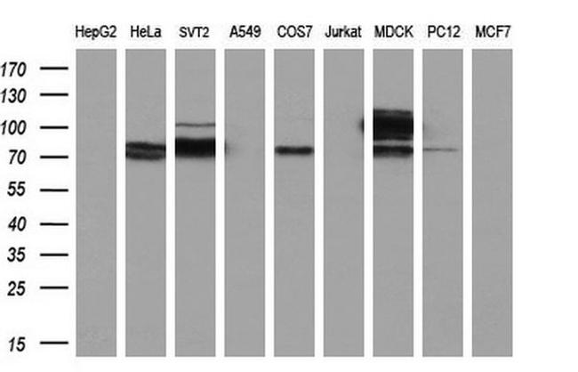 ACSS2 Antibody in Western Blot (WB)