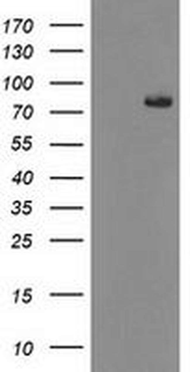 ACSS2 Antibody in Western Blot (WB)