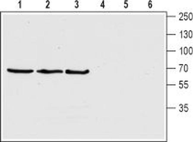 Choline Transporter (SLC5A7) (extracellular) Antibody in Western Blot (WB)