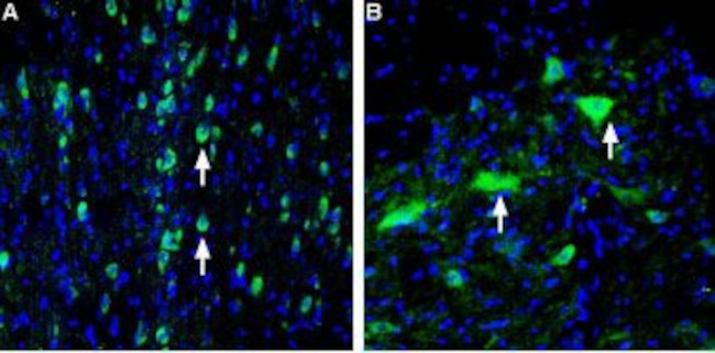 Vesicular Acetylcholine Transporter (VAChT) Antibody in Immunohistochemistry (Frozen) (IHC (F))