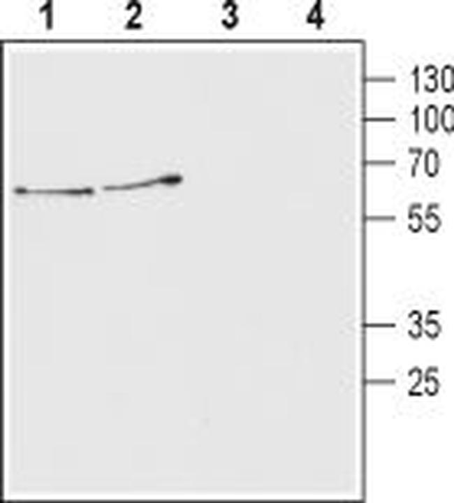 Vesicular Acetylcholine Transporter (VAChT) Antibody in Western Blot (WB)