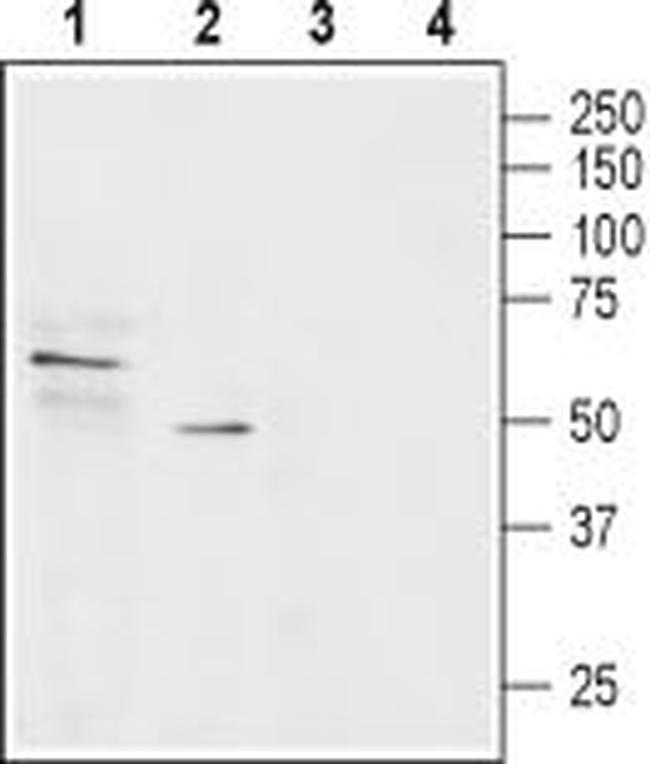 SLC22A1 Antibody in Western Blot (WB)