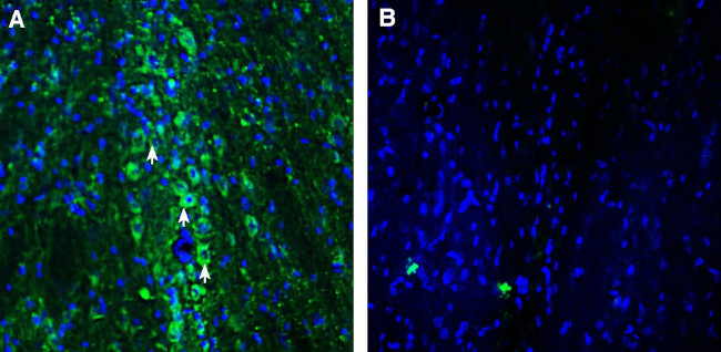 SLC22A2 (OCT2) Antibody in Immunohistochemistry (Frozen) (IHC (F))