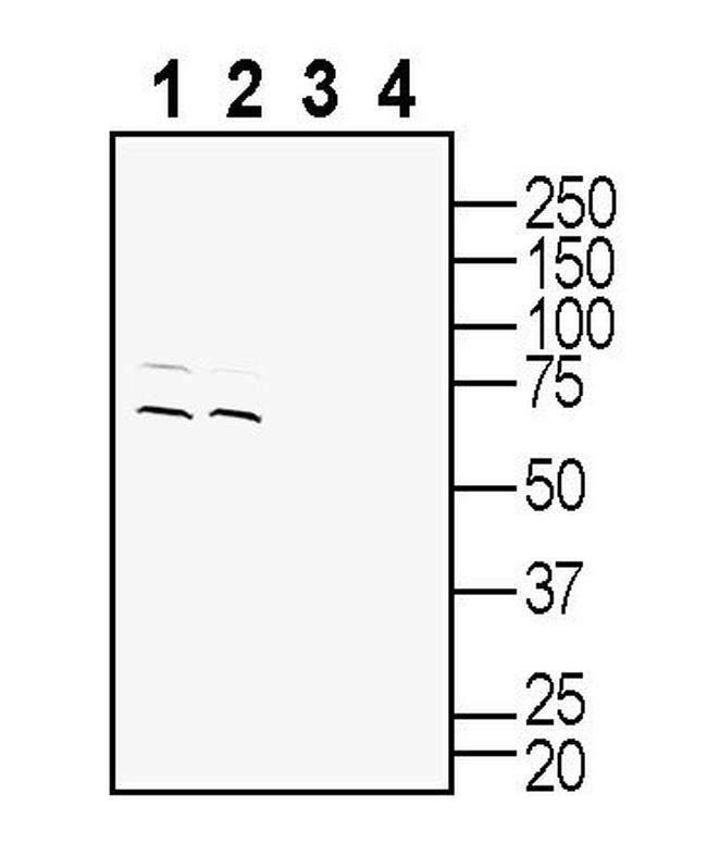 SLC22A2 (OCT2) Antibody in Western Blot (WB)