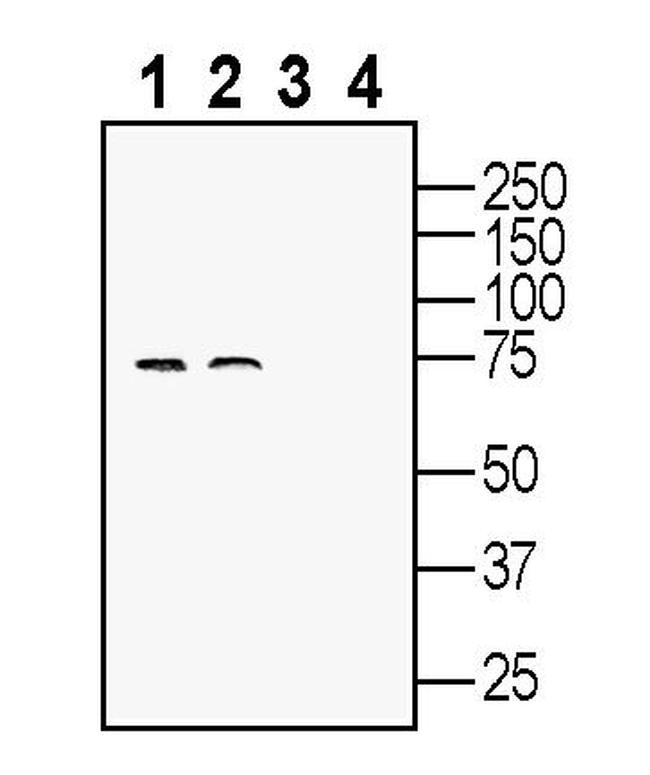 SLC22A2 (OCT2) Antibody in Western Blot (WB)