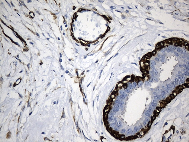 ACTA2 (smooth muscle actin alpha, SMA) Antibody in Immunohistochemistry (Paraffin) (IHC (P))