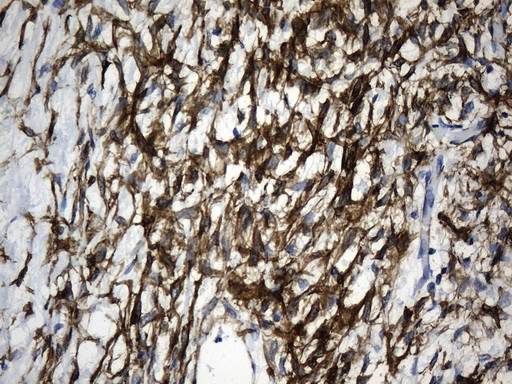 ACTA2 (smooth muscle actin alpha, SMA) Antibody in Immunohistochemistry (Paraffin) (IHC (P))