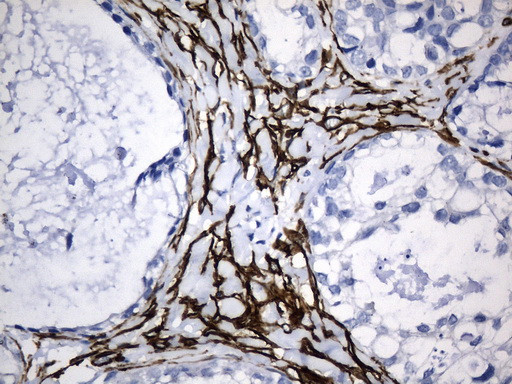 ACTA2 (smooth muscle actin alpha, SMA) Antibody in Immunohistochemistry (Paraffin) (IHC (P))