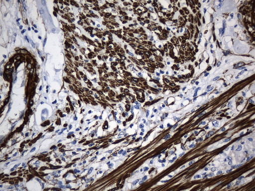 ACTA2 (smooth muscle actin alpha, SMA) Antibody in Immunohistochemistry (Paraffin) (IHC (P))