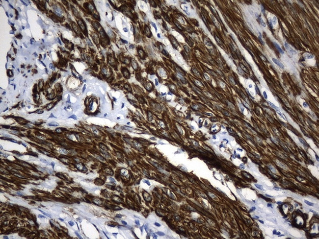 ACTA2 (smooth muscle actin alpha, SMA) Antibody in Immunohistochemistry (Paraffin) (IHC (P))