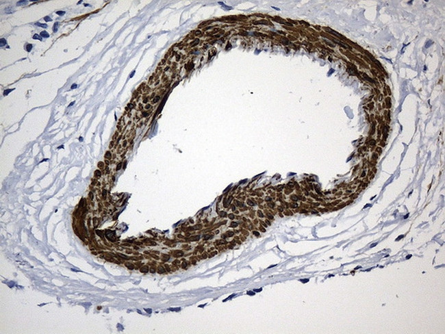 ACTA2 (smooth muscle actin alpha, SMA) Antibody in Immunohistochemistry (Paraffin) (IHC (P))