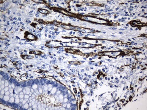 ACTA2 (smooth muscle actin alpha, SMA) Antibody in Immunohistochemistry (Paraffin) (IHC (P))