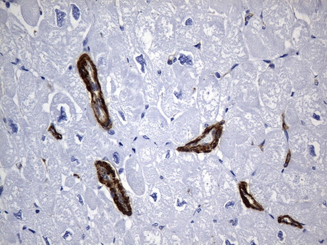 ACTA2 (smooth muscle actin alpha, SMA) Antibody in Immunohistochemistry (Paraffin) (IHC (P))