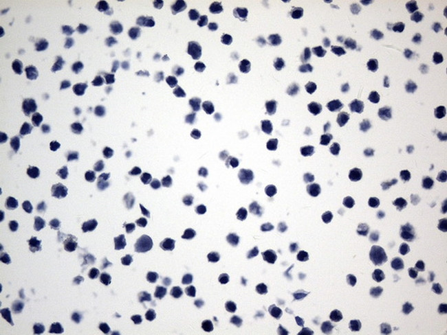 ACTA2 (smooth muscle actin alpha, SMA) Antibody in Immunohistochemistry (Paraffin) (IHC (P))