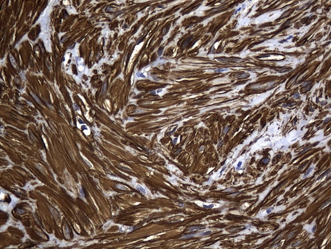 ACTA2 (smooth muscle actin alpha, SMA) Antibody in Immunohistochemistry (Paraffin) (IHC (P))