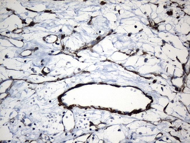 ACTA2 (smooth muscle actin alpha, SMA) Antibody in Immunohistochemistry (Paraffin) (IHC (P))