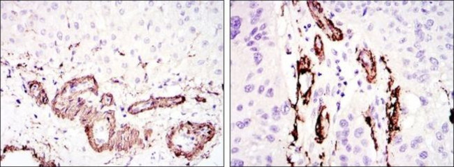 Alpha-Smooth Muscle Actin Antibody in Immunohistochemistry (Paraffin) (IHC (P))