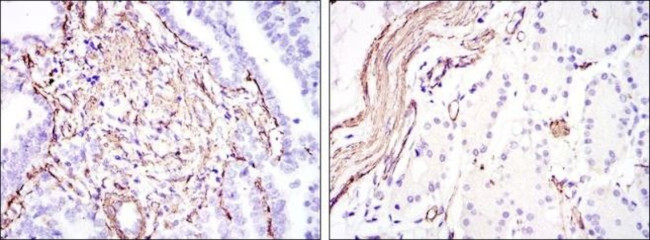 Alpha-Smooth Muscle Actin Antibody in Immunohistochemistry (Paraffin) (IHC (P))