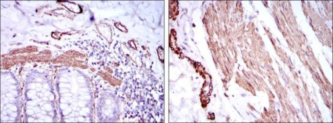 Alpha-Smooth Muscle Actin Antibody in Immunohistochemistry (Paraffin) (IHC (P))