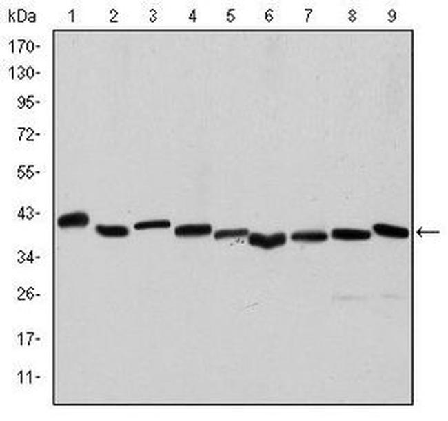 Alpha-Smooth Muscle Actin Antibody in Western Blot (WB)