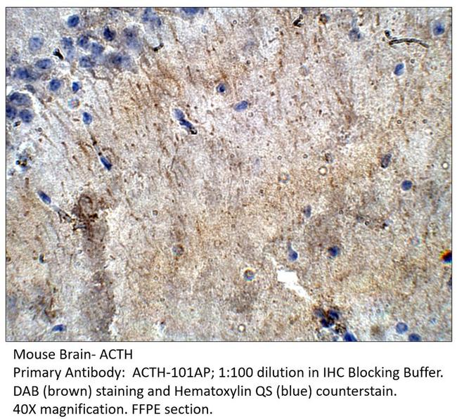 ACTH Antibody in Immunohistochemistry (Paraffin) (IHC (P))