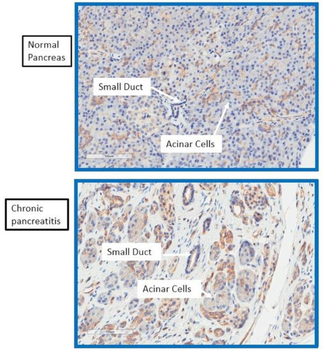 alpha Actinin 2 Antibody in Immunohistochemistry (IHC)