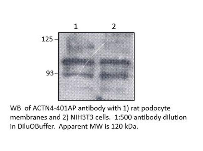 alpha Actinin 4 Antibody in Western Blot (WB)