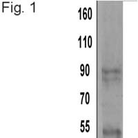 alpha Actinin 4 Antibody in Western Blot (WB)