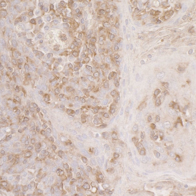 ACTR2/ARP2 Antibody in Immunohistochemistry (IHC)