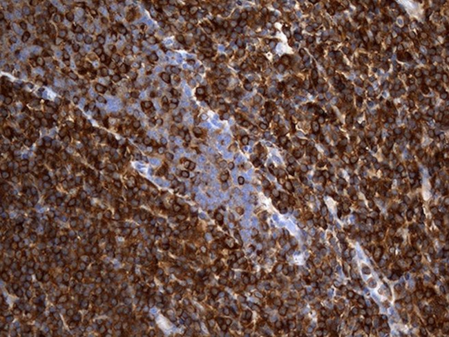 ACTR3 Antibody in Immunohistochemistry (Paraffin) (IHC (P))