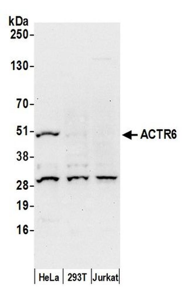 ACTR6 Antibody in Western Blot (WB)