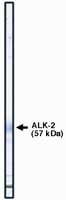 ACVR1 Antibody in Western Blot (WB)