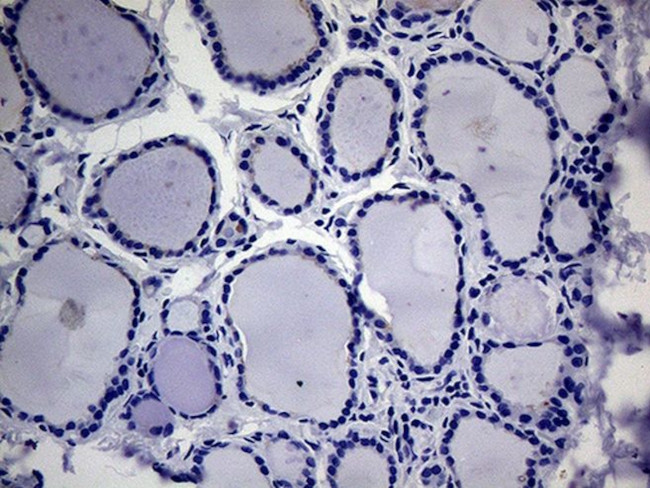 ACVR2A Antibody in Immunohistochemistry (Paraffin) (IHC (P))