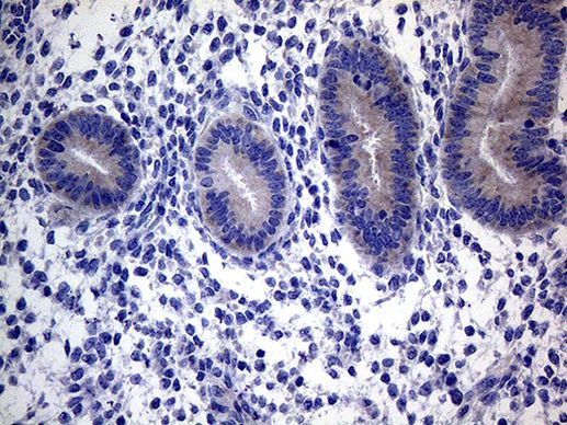 ACVR2A Antibody in Immunohistochemistry (Paraffin) (IHC (P))