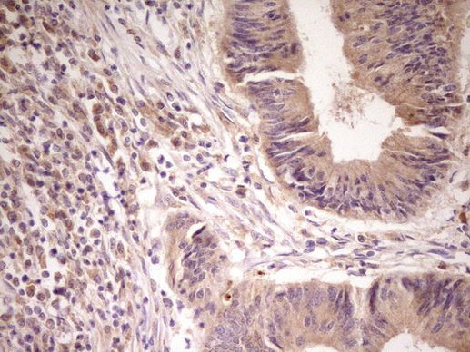 ACVR2A Antibody in Immunohistochemistry (Paraffin) (IHC (P))