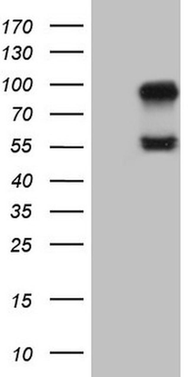 ACVR2A Antibody in Western Blot (WB)