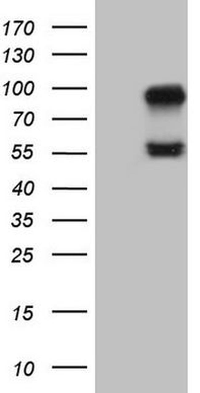 ACVR2A Antibody in Western Blot (WB)