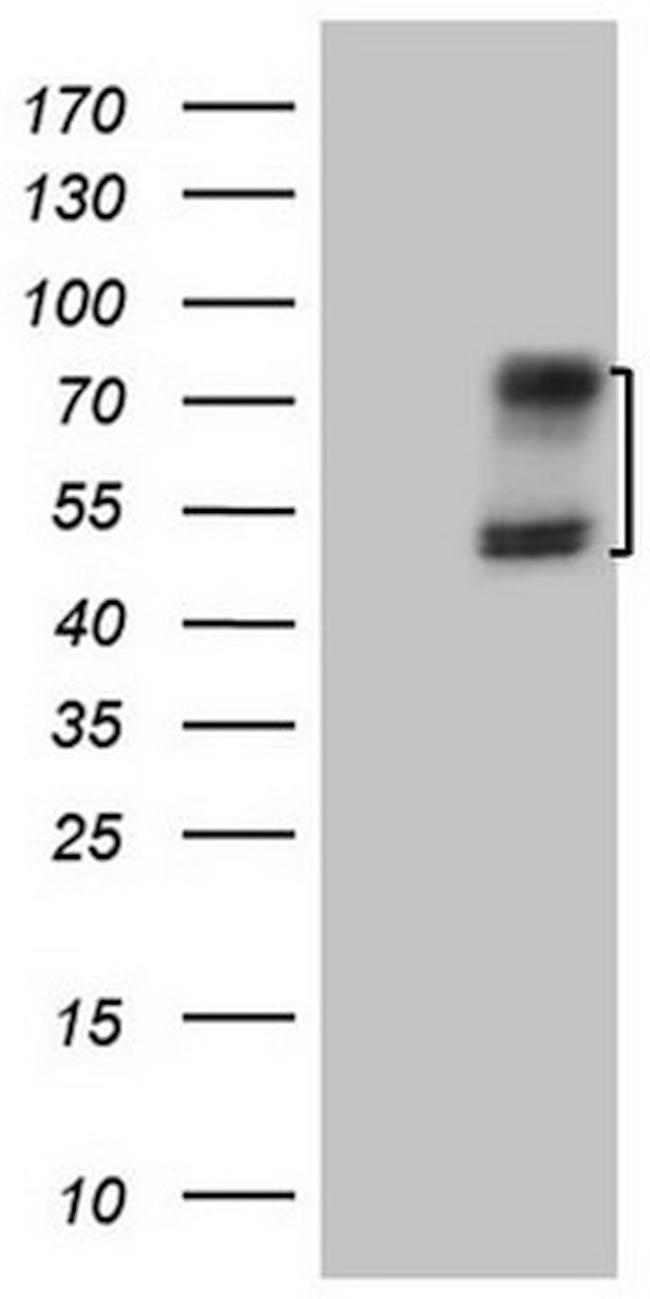 ACVR2A Antibody in Western Blot (WB)