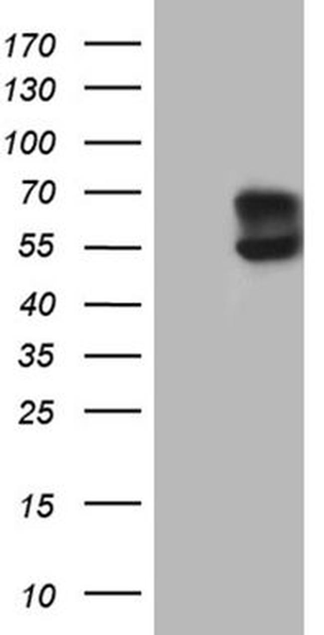 ACVRL1 Antibody in Western Blot (WB)