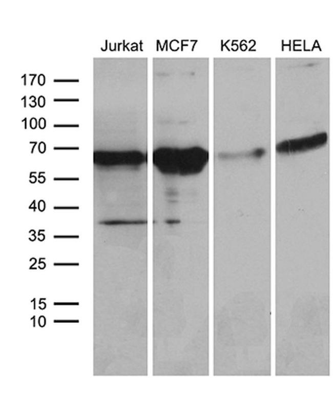 ACVRL1 Antibody in Western Blot (WB)