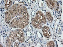 ACY1 Antibody in Immunohistochemistry (Paraffin) (IHC (P))