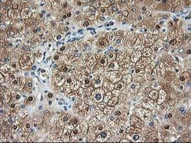 ACY1 Antibody in Immunohistochemistry (Paraffin) (IHC (P))