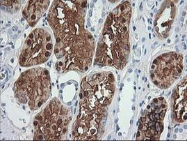 ACY1 Antibody in Immunohistochemistry (Paraffin) (IHC (P))