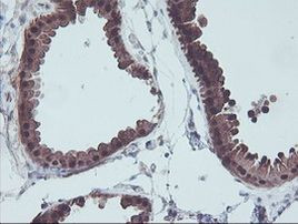 ACY1 Antibody in Immunohistochemistry (Paraffin) (IHC (P))