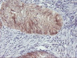 ACY1 Antibody in Immunohistochemistry (Paraffin) (IHC (P))